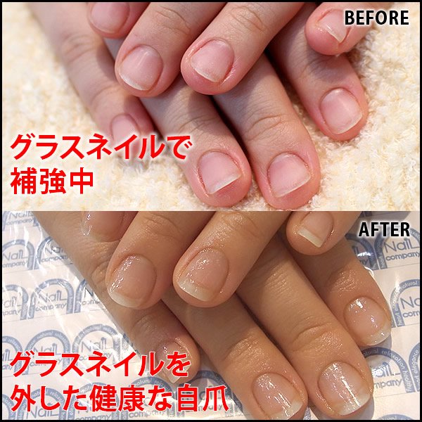 饹ͥ䶯Before&After